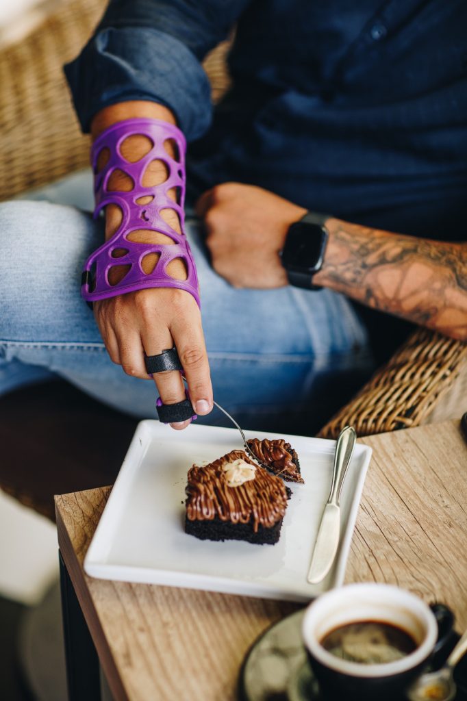 Cuidados fundamentais para uma boa recuperação, após a retirada do gesso. 2