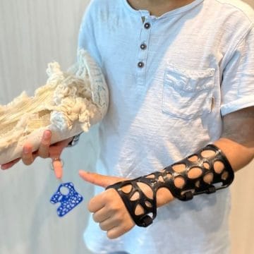 Gesso apertado é normal? 1