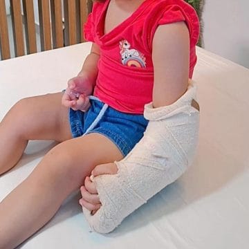 Cuidados fundamentais para uma boa recuperação, após a retirada do gesso. 2