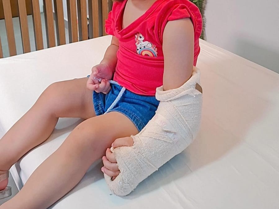 Cuidados fundamentais para uma boa recuperação, após a retirada do gesso. 2